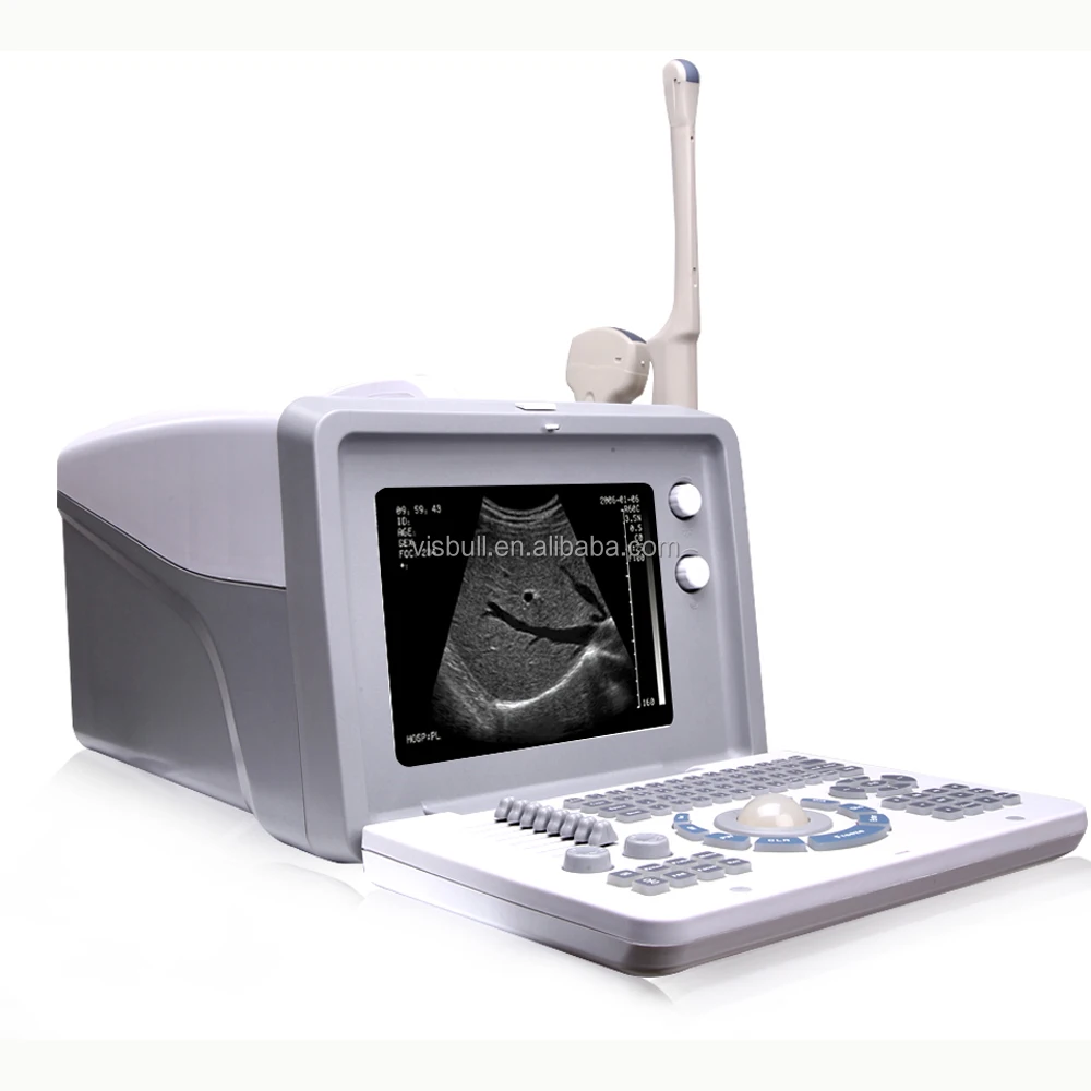 vs-2018ci便携式超声扫描仪/超声设备中国/怀孕用超声仪