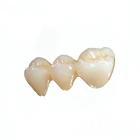 Zotion dental material zircon disk porcelain denture teeth