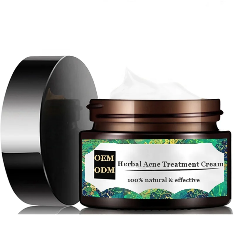 redness cream for acne