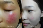 Skin Multi Salon Beauty Equipment Face Machine Skin Care Products Max Oem Touch Color Package Output Tft Multi