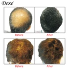 Cotton Fiber Hair Cotton Fiber