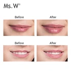 Unique Gift Unique Rechargeable Instant Lip Plumper Device Private Label Lips Enhancer Device Home Use Gift