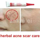Products Cream Best Clinic Products Scar Removal Cream 30g