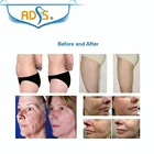 Cavitation Machine Cavitation Machine Vacuum Cavitation System Body Slimming Machine / Skin Lifting Wrinkle Removal Machine