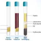 Tube High Concentration PRP Tube With ACD And Gel CPT Tube Prp Kit