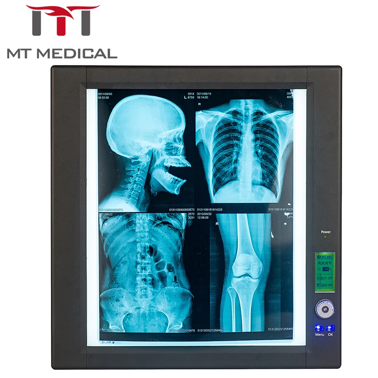 医用led过失镜单x光胶片扫描仪 buy medical x-ray scanner,negato