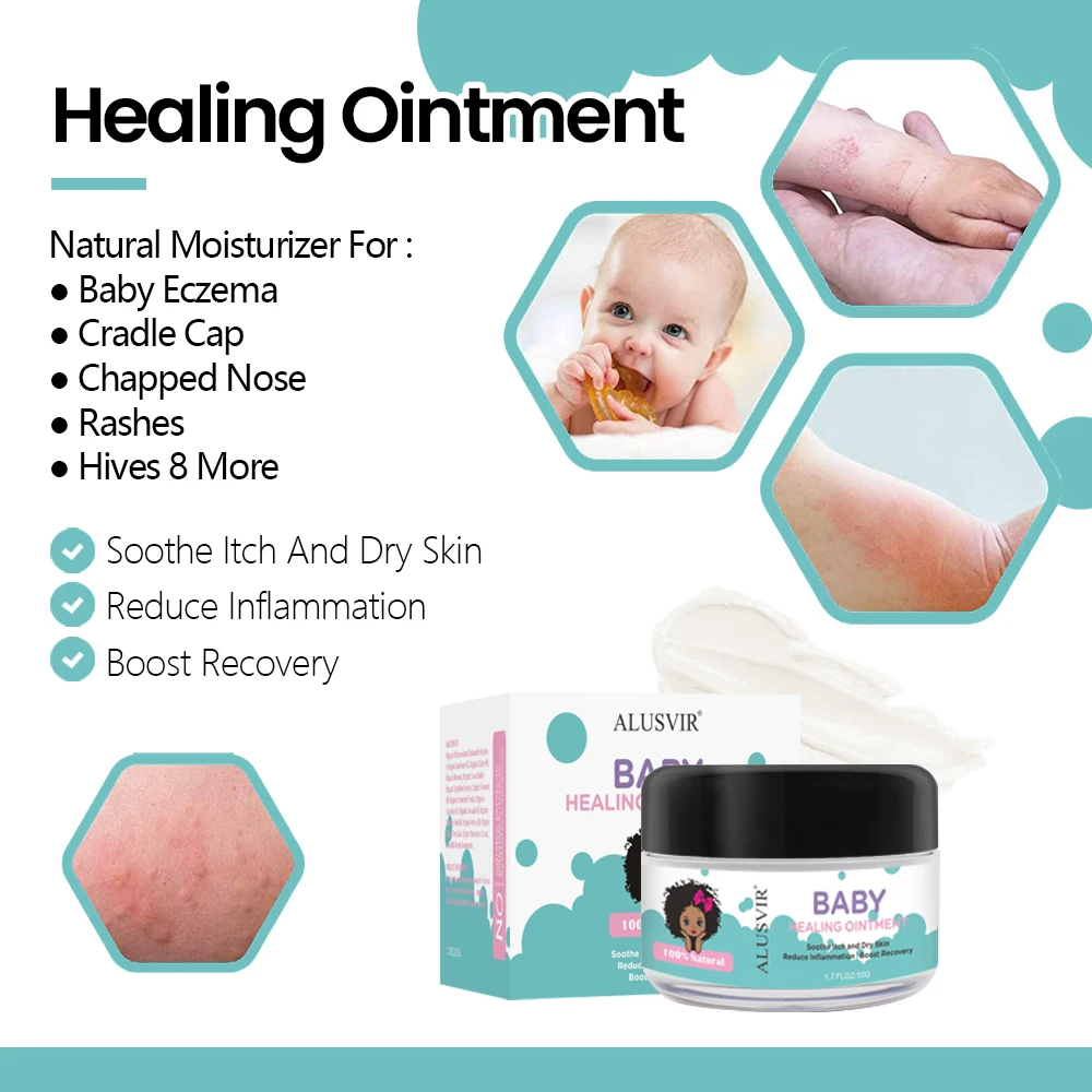 Baby Kids Care Organic Body Skin Care Soothe Itch Dry Skin Inflammation Eczema Rashes Healing Ointment Cream Skin