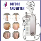 Fat Rf Vacuum Simple Operation 5 In 1 Fat Freezing Cryo Cavitation Rf Vacuum Slim Fit Body Shaping Machine
