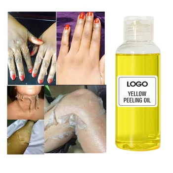 Strong remove dark knees and elbows shiny body brightening whitening dark knuckles skin extra strength yellow peeling oil