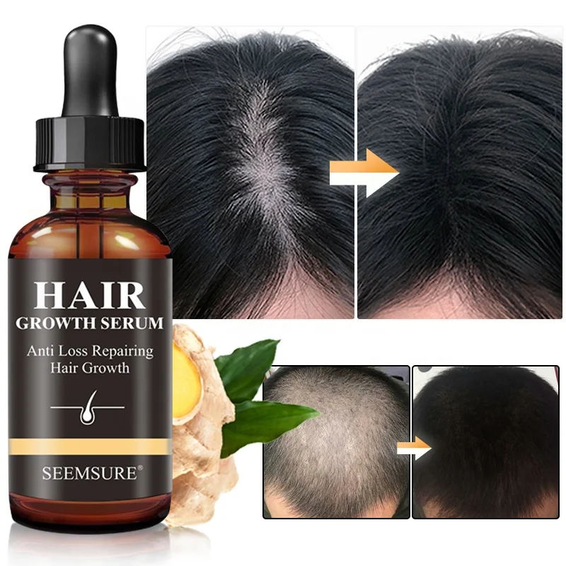 Private Label Ginger Hair Regrowth Conditioners Anti Loss Serums Essential  Oil Natural Hair Care Serum Treatment Growth Oils - Buy Sesame Oil For Hair,Hair  Growth Oil,Hair Care Serum Product on 