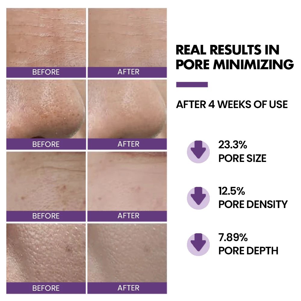 Private Label Skin Care Products Set Pores Minimizer Shrinking Pores Face Toner Spray Serum Cream Skincare Set For Skin