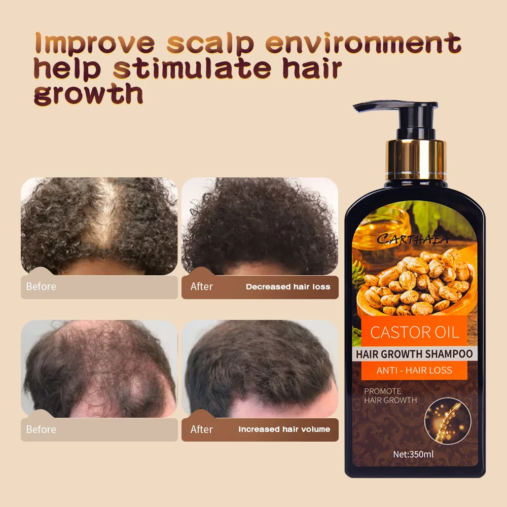 Wholesale natural beauty products anti- hair loss organic ginger shampoo castor oil hair growth shampoo for men and women