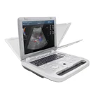 System Promotion Contec Manufacture Color Doppler Ultrasonic Diagnostic System CMS1700A