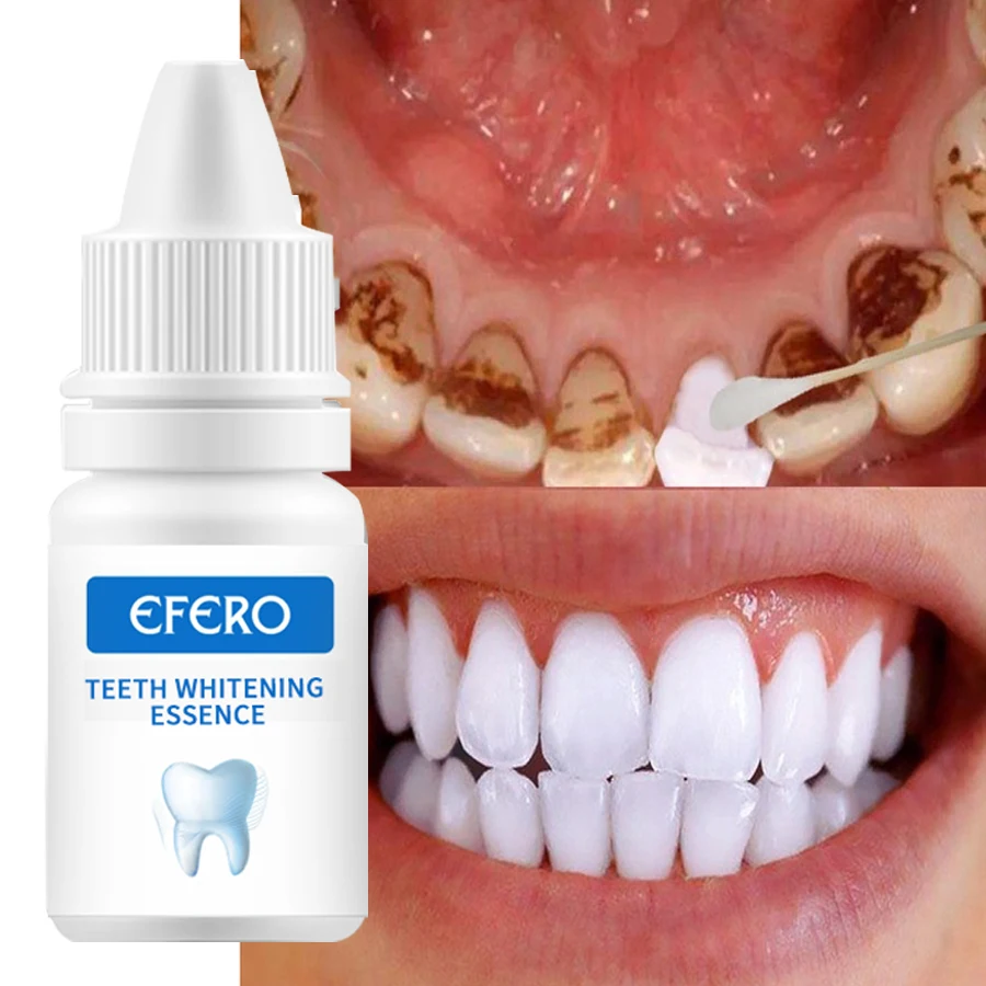 teeth white cream