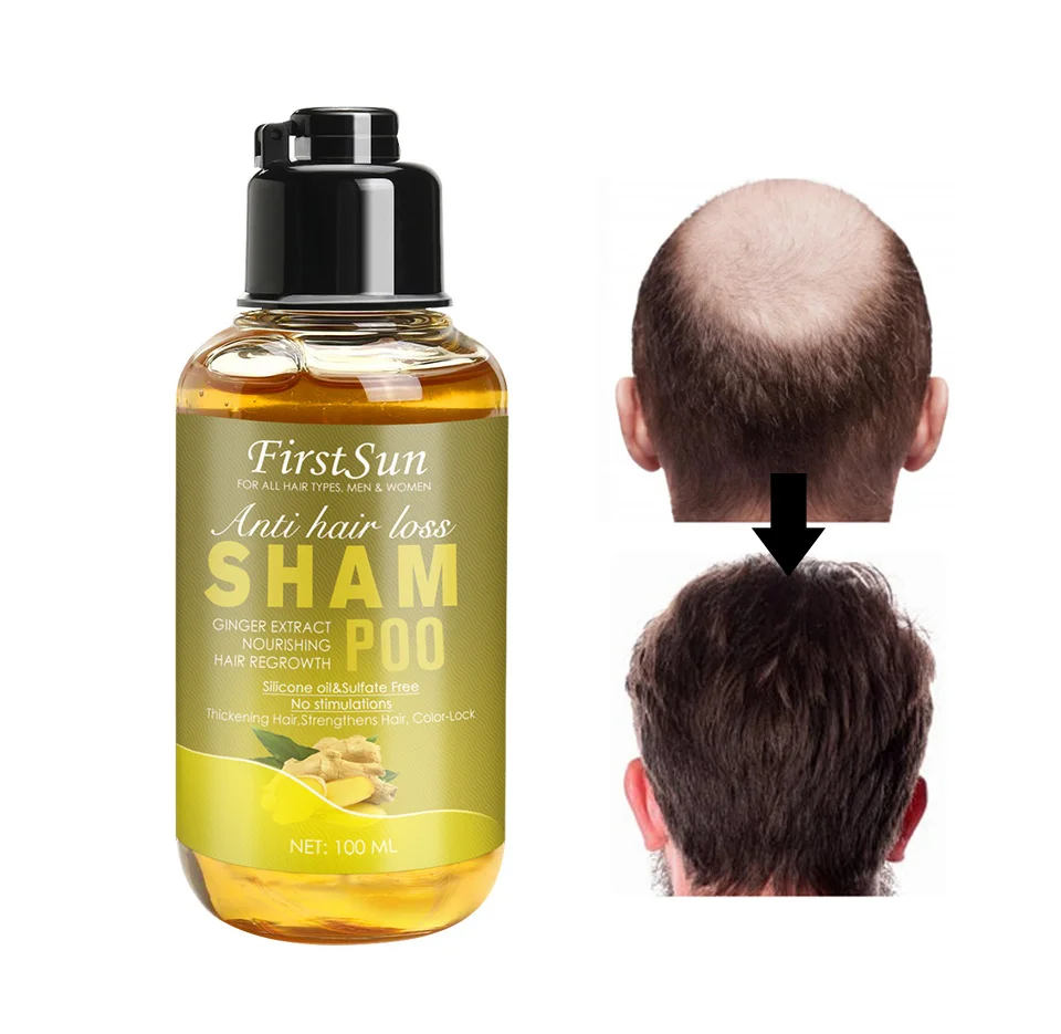 hair growth shampoo