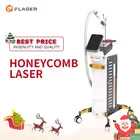 Tattoo Removal Laser Tattoo Laser Removal Q Switched Nd Yag Laser Tattoo Removal Price