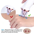 Hot Sale Cleaning Beauty Device Electric 5 In 1 Blackhead Remover Vacuum Suction Cleanser