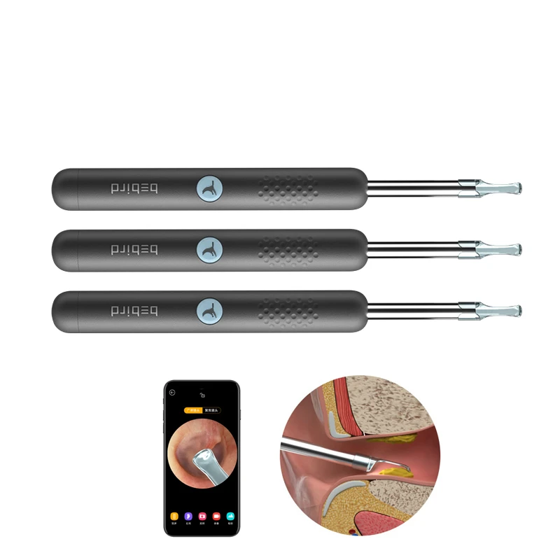 best ear cleaning endoscope