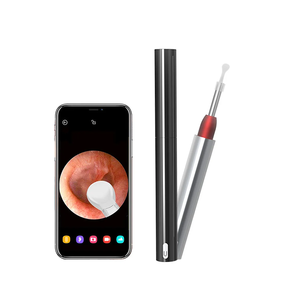 anykit otoscope app