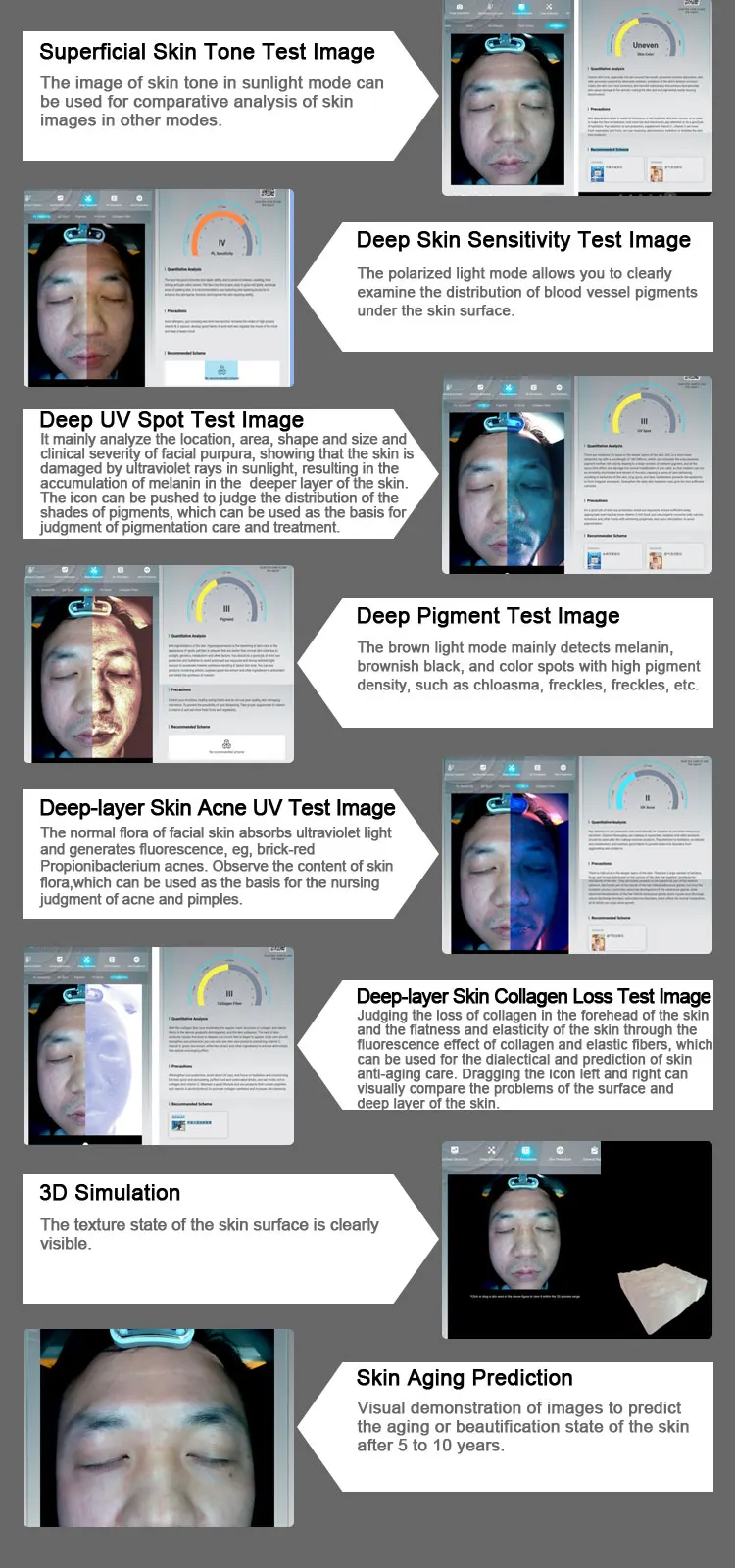 Professional Skin Analysis Machine AI 3D Facial Skin Scanner for Sale 13 Upgrade your consultation accuracy with our AI Skin Analysis Machine. Featuring 3D imaging, multi-spectrum detection, and intelligent reports for dermatology clinics, med spas, and aesthetic centers. Professional Skin Analysis Machine AI 3D Facial Skin Scanner for Sale