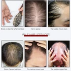 Dandruff 800 Ml Shampoo Hair Loss And Dandruff Treatment Manufacturer