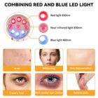 Remover Removal Acne Removal OEM 630nm Red Light 450nm Blue Light Acne Killer Acne Remover Tool Acne Removal