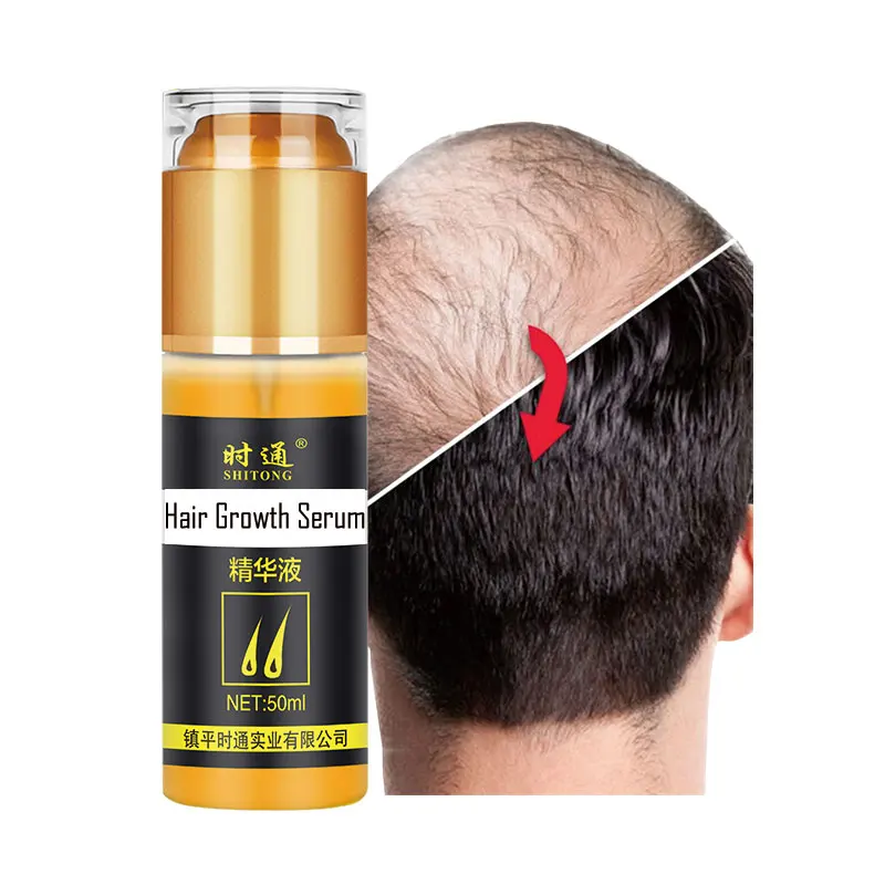 Hot Selling Honey High Scalp Massage Promotes Oil Care Grow Strength  Quality Japanese Rapid New Serum Hair Growth Oils - Buy Edge Loss Anti  Control Booster Balding Ed Duxi Bald Afriqye Dsy