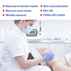 Machine For Machine Rf Portable Radio Fractional Stretch Marks Removal Microneedling Machine Fractional Rf For Sale