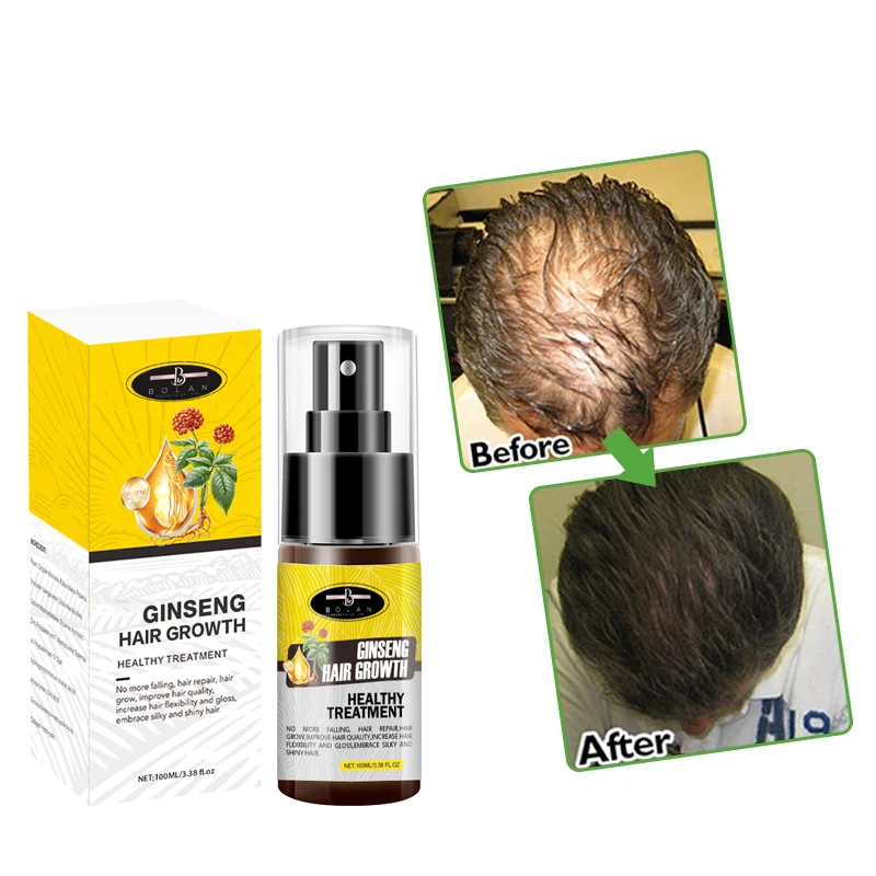 Oem Provide Label Nanohair Hair Regrowth Treatment Organic Biotin Men Growth  Hair Spray - Buy Nanohair Hair Regrowth Treatment,Provide Label Hair Growth  Spray,Grow Hair Product on 