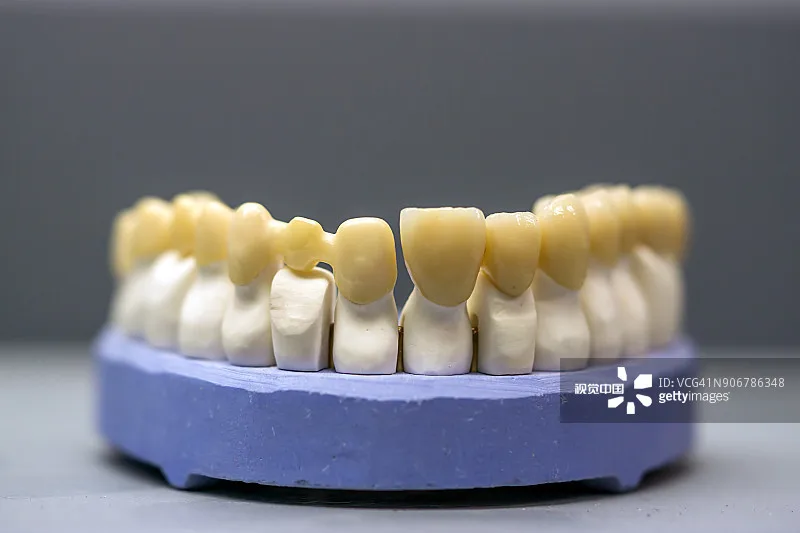 YUCERA ST White Zirconia Block Dental Lab Use Cad Cam 98mm White Blank Zirconia Blocks for 5 Axis Dental Milling Machine