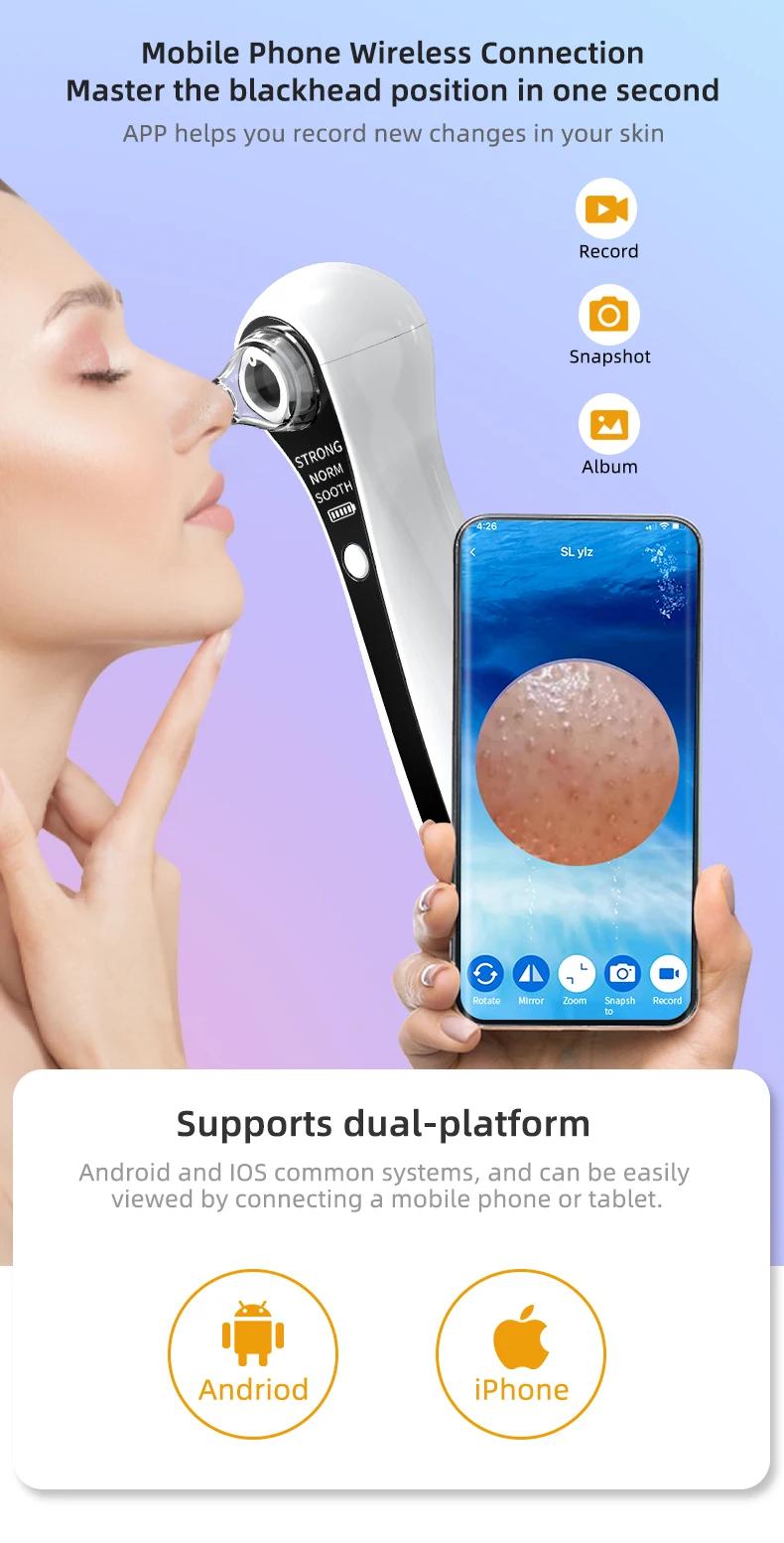 usb可充电高清摄像头毛孔真空升级面部毛孔清洁器电动粉刺白头提取器工具黑头去除器