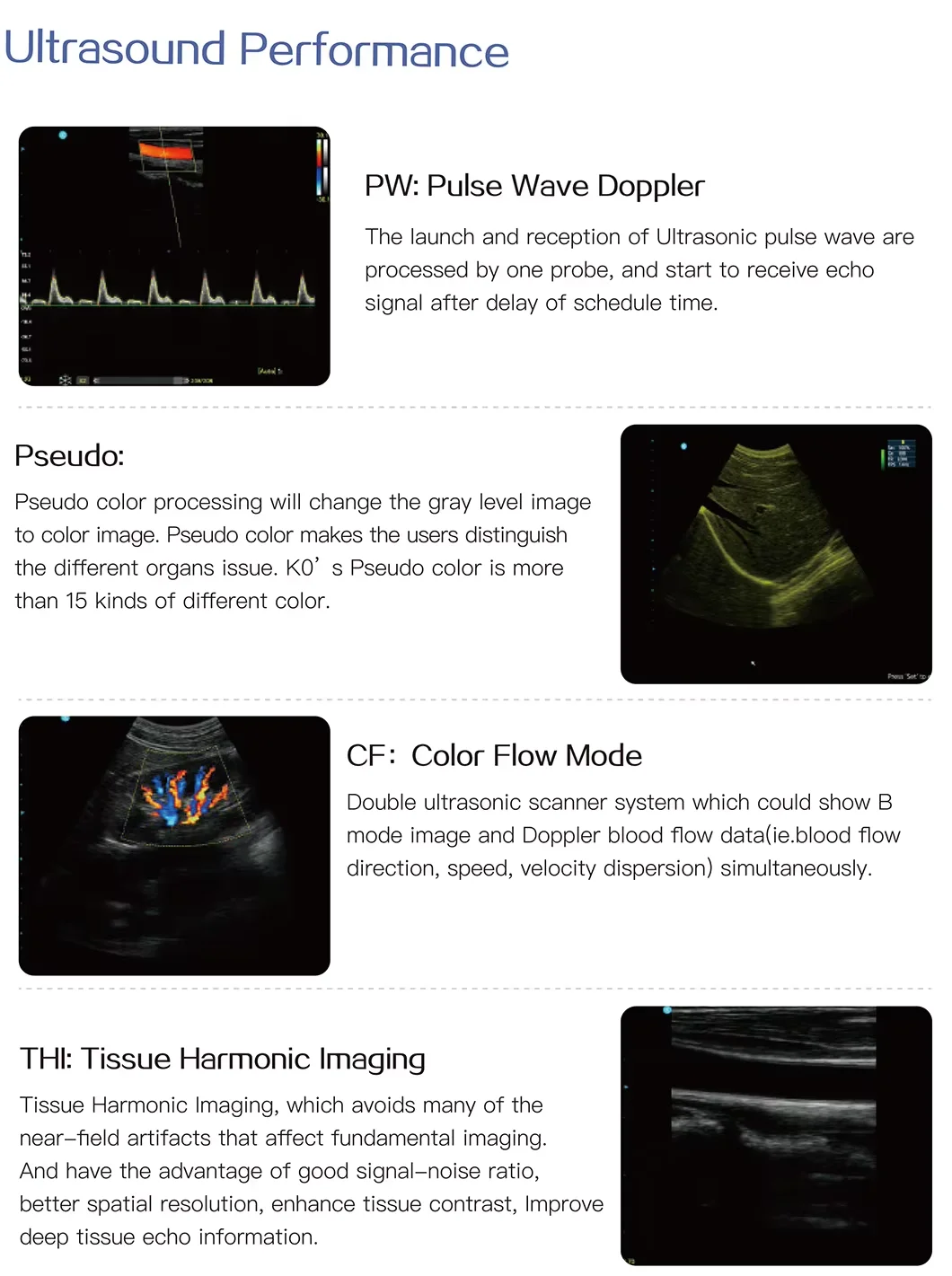 Portable PC Platform Color Full Digital Ultra Sound Scan Portable Laptop Ultrasound Machine supplier