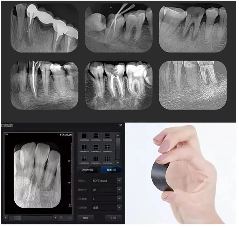 Dental X Ray Intraoral Digital Imaging Phosphor Plate Scanner And