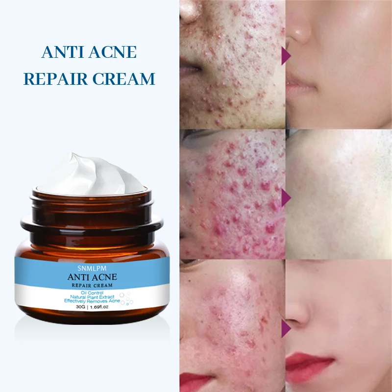 snmlpm freckle cream