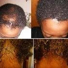 Hair Hair Growth Good Effect Private Label Hair Growth Oil 100% Natural Hair Growth Serum Drops
