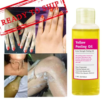 OEM Chemical Skin Whitening Oil Serum Strong Dark Knuckles Yellow Effective Peeling Oil Whitening Yellow Peeling Oil For Skin Ca