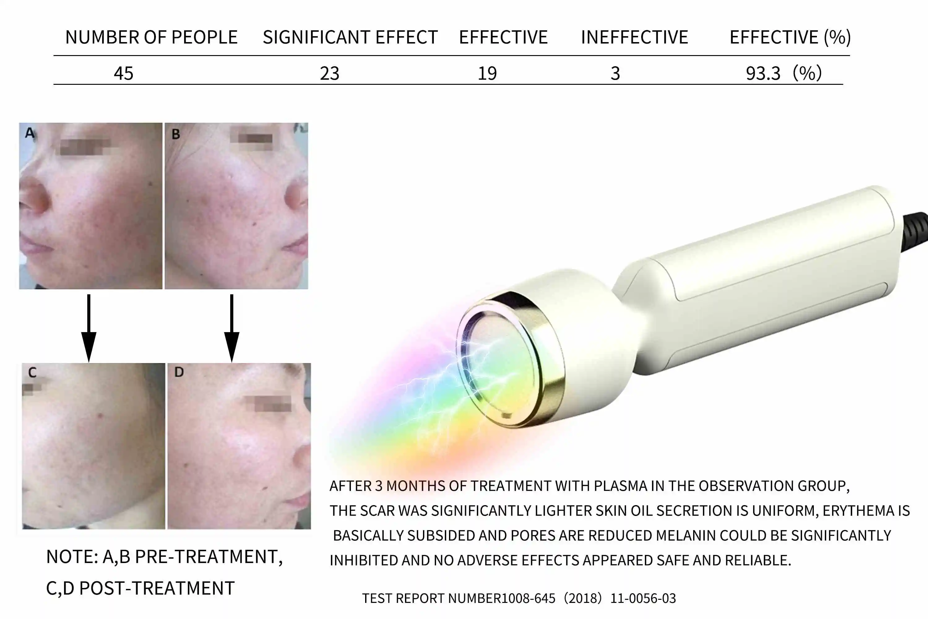 Skin Microdermabrasion Machine Hydrodermabrasion Exfoliation Microdermabrasion Blackhead Remover