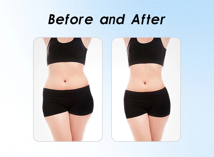 Apolomed Cryolipolysis Machine for Body Slimming details