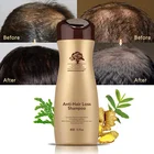 Hair Loss Cure Shampoo 2019 Best Anti Alopecia Ginger Hair Loss Treatment Male Baldness Cure Shampoo Products