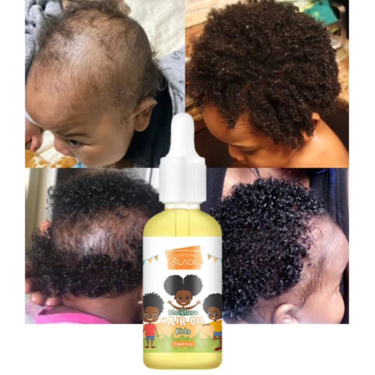 Natural Sultfate Free Hair And Scalp Deep Treatment Baby Hair Growth Oil  For Kids Regrowth - Buy Baby Hair Growth Oil,Baby Hair Oil,Kids Hair Oil  Product on 