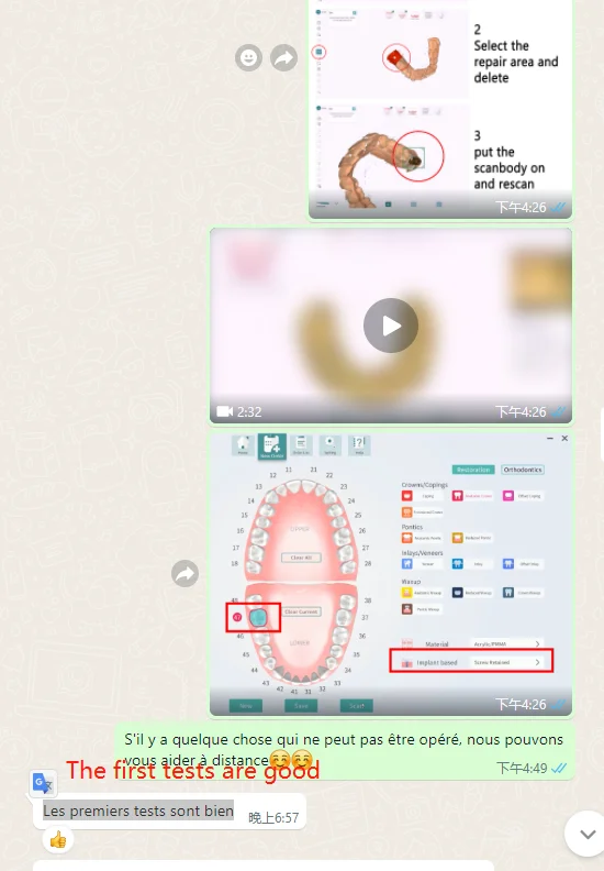 Escaner 3D Intraoral Escner Dental Panda Escner Yucera Dental Intraoral Escaner Intraoral