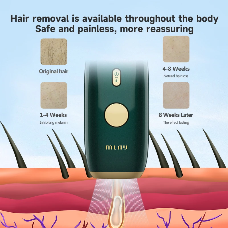 Hot Sale Portable IPL Hair Removal Device Best Handheld Home Use with Advanced Hair Removal Technology OEM Logo Upgraded