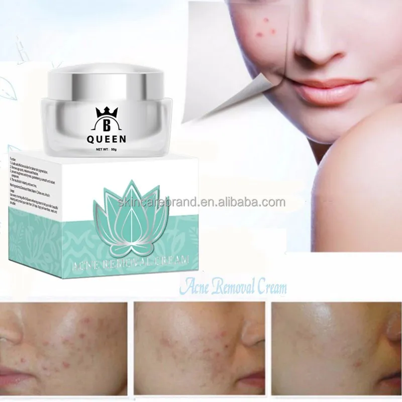 Acne Pimple Removal Cream Made In Korea Buy Acne Cream,Acne Pimple