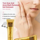 Cream Scar Removal Cream Acne Keloid Scar Removal Cream