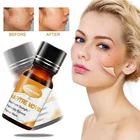 Remover Private Label 100% Natural Foot Hand Callus Wart Remover Liquid Essence