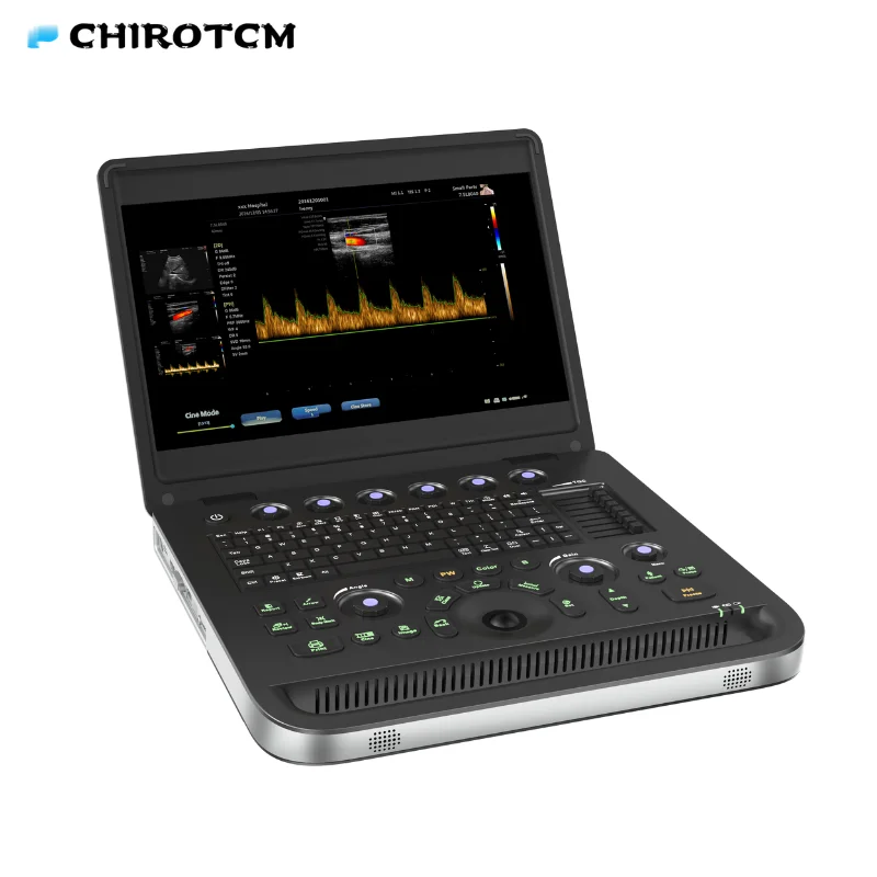 doppler ultrasound CU01