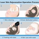 Laser Nd Yag Embroider Skin Spot Eyes Line Lip And Eyebrow Tattoo Removal Machine