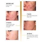 Anti Whitening Serum Holu Snail Whitening Extract Serum Collagen Anti Aging Serum