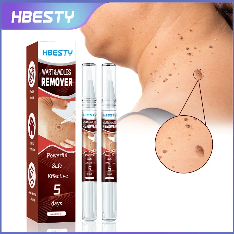 OEM Wart & Moles Cream for Improving Skin Problem