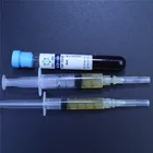 World Prp Growth Factor Injections /injured Joints/ Vaginal Atrophy PRP TUBE PRP KIT